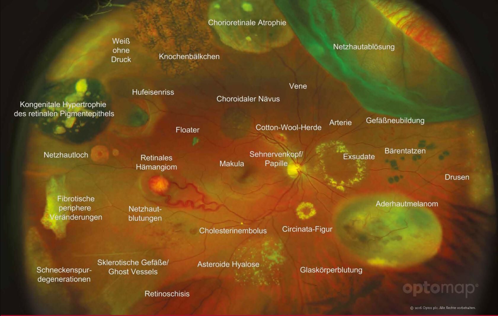 Ultra-Weitwinkel-Netzhautbildgebung